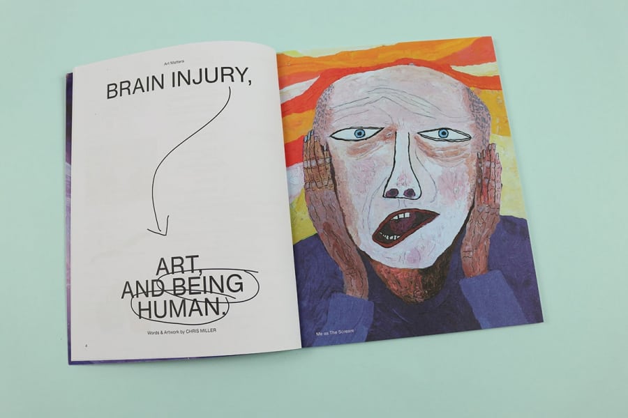 Mathair Magazine Matter magazine takes a beautiful, touching look at living with brain ...
